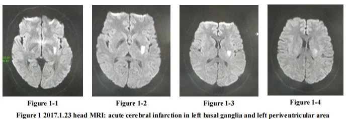 head MRI head MRI