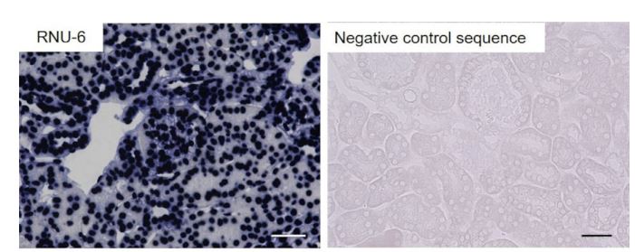 In situ hybridization images for miRNA-181b-5p and miRNA-125b-5p in kidneys In situ hybridization images for miRNA-181b-5p and miRNA-125b-5p in kidneys