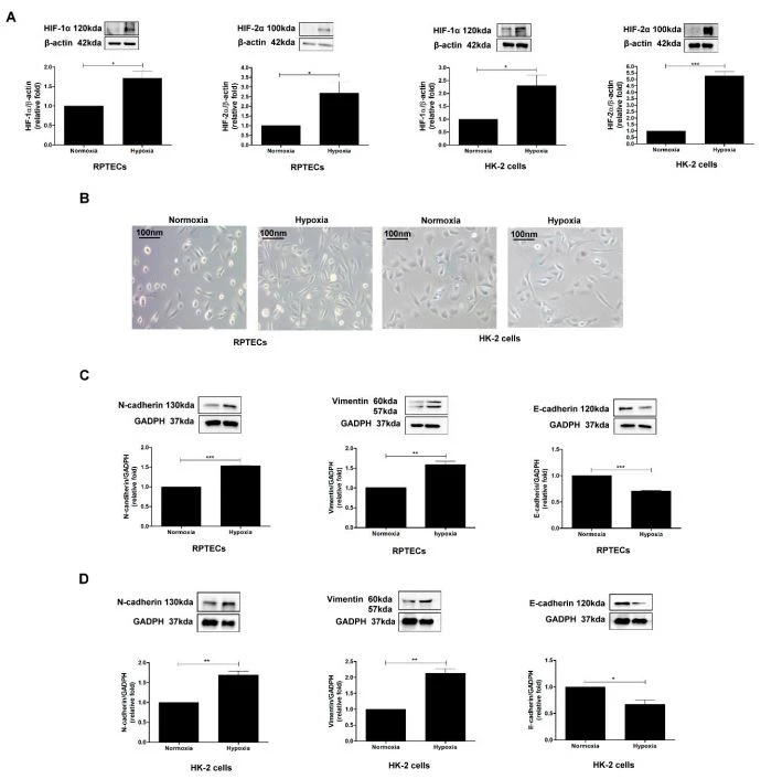 Figure 1. Hypoxia induces EMT in PTECs. (A) HIF-1α and HIF-2α expression were assessed in RPTECs and HK-2 cells  were incubated under normoxia (O2, 21%) and hypoxia (O2, 1%) conditions for 6 h using Western blotting. (B) The effect  of hypoxia on morphological changes in RPTECs and HK-2 cells under normoxia and hypoxia conditions for 48 h. EMT  markers (E-cadherin, N-cadherin, and vimentin) were examined in human RPTECs (C) and HK-2 cells (D) treated with  normoxia and hypoxia for 48 h using Western blotting. The bar graph represents the mean ± SEM of at least three independent experiments. * p < 0.05, ** p < 0.01, *** p < 0.001 by Student's t-test. Figure 1. Hypoxia induces EMT in PTECs. (A) HIF-1α and HIF-2α expression were assessed in RPTECs and HK-2 cells were incubated under normoxia (O2 , 21%) and hypoxia (O2 , 1%) conditions for 6 h using Western blotting. (B) The effect of hypoxia on morphological changes in RPTECs and HK-2 cells under normoxia and hypoxia conditions for 48 h. EMT markers (E-cadherin, N-cadherin, and vimentin) were examined in human RPTECs (C) and HK-2 cells (D) treated with normoxia and hypoxia for 48 h using Western blotting. The bar graph represents the mean ± SEM of at least three independent experiments. * p < 0.05, ** p < 0.01, *** p < 0.001 by Student's t-test.